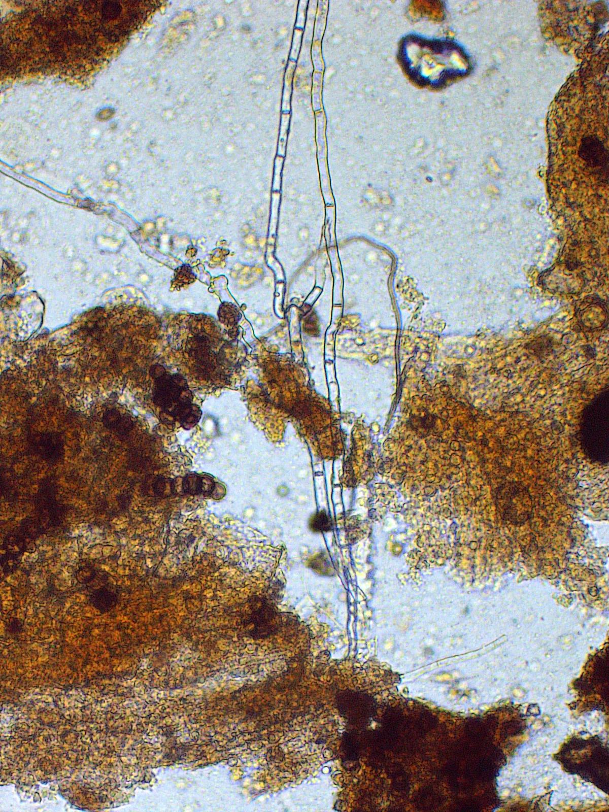 Bacteria-feeding nematode under the microscope